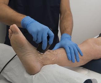 Shockwave Therapy in Walsall